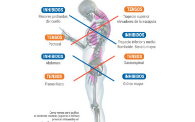 Síndrome cruzado superior e inferior