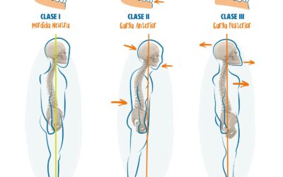 Si tengo mal la espalda, ¿por qué me miras la boca? La mordida afecta a la postura