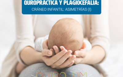 Quiropráctica y plagiocefalia. Asimetrías o deformaciones craneales en bebés.